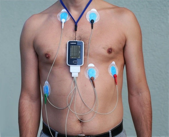 The modern Holter ECG